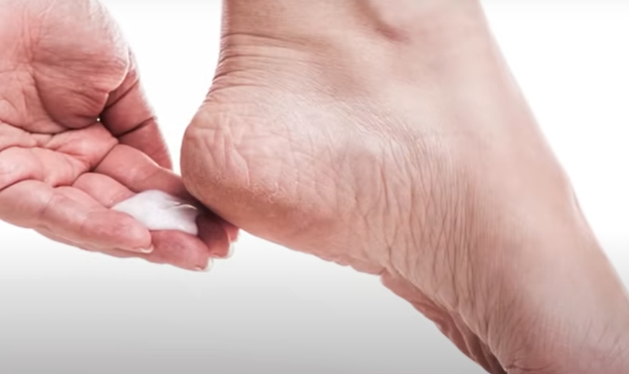 How Your Feet Are Warning You About Your Liver Problems
